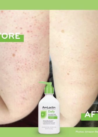 AmLactin | Daily Moisturizing Body Lotion - ყოველდღიური დამატენიანებელი ლოსიონი რძემჟავით - Image 4