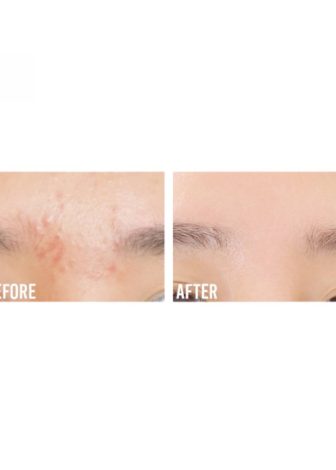 Beauty Of Joseon Glow Serum : Propolis + Niacinamide - Image 3
