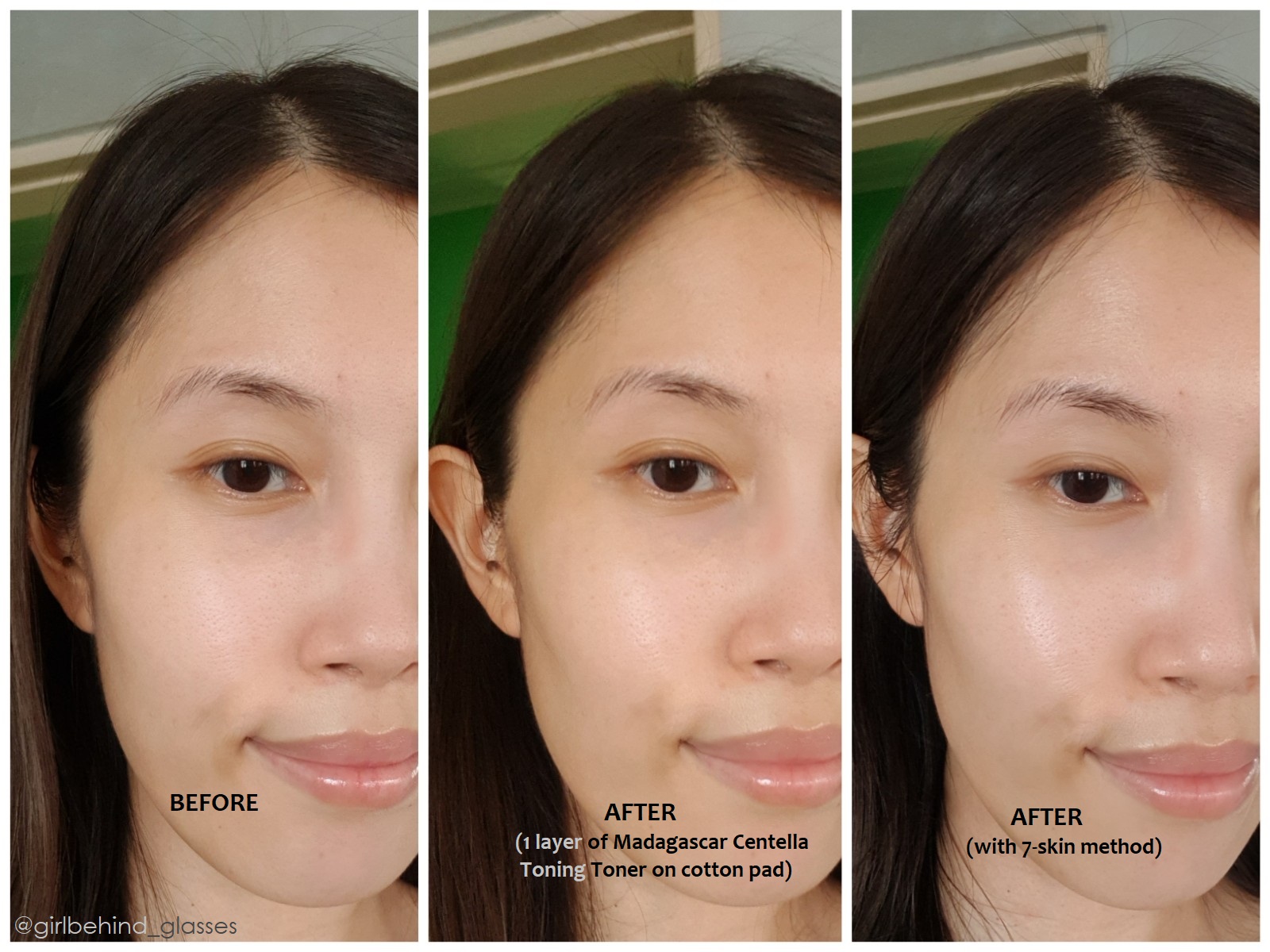 korean-skincare-4-betterskin-ge