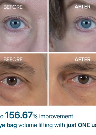 Dr.Melaxin EYEPHALT Eye Cream for Eyebags 10ml - Image 2